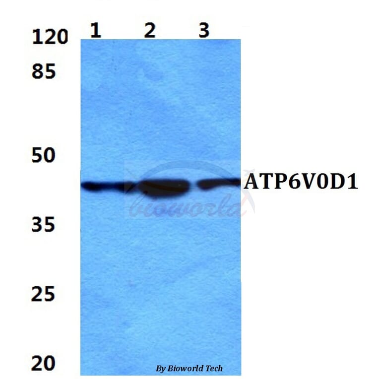Anti-ATP6V0D1 Antibody from Bioworld Technology (BS5977) - Antibodies.com