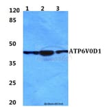 Anti-ATP6V0D1 Antibody from Bioworld Technology (BS5977) - Antibodies.com