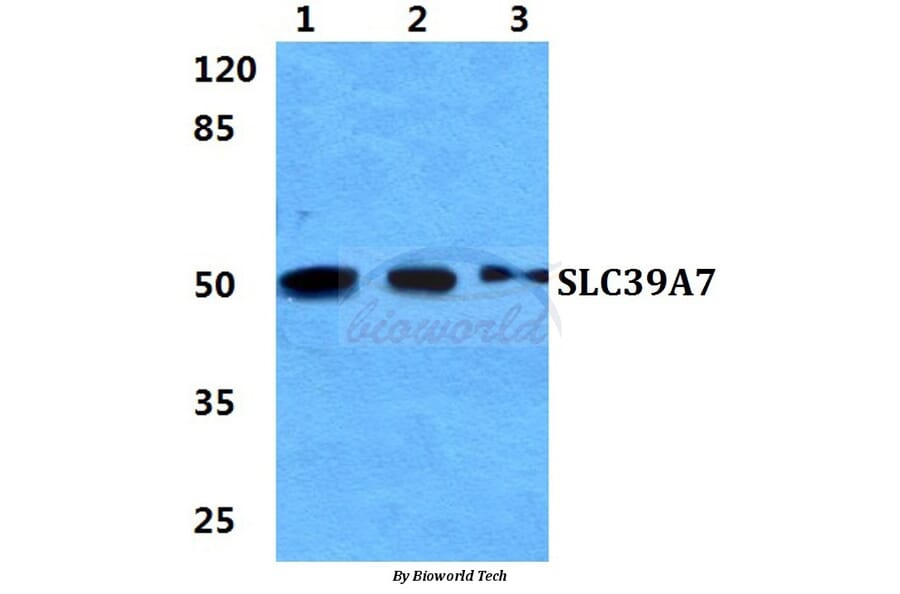 Anti-SLC39A7 Antibody from Bioworld Technology (BS5979) - Antibodies.com