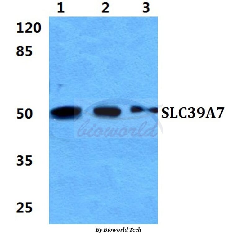 Anti-SLC39A7 Antibody from Bioworld Technology (BS5979) - Antibodies.com
