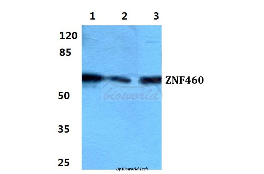 Anti-ZNF460 Antibody from Bioworld Technology (BS5980) - Antibodies.com