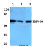 Anti-ZNF460 Antibody from Bioworld Technology (BS5980) - Antibodies.com