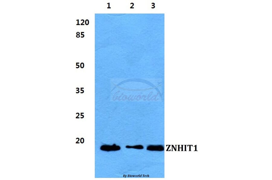 Anti-ZNHIT1 Antibody from Bioworld Technology (BS5982) - Antibodies.com
