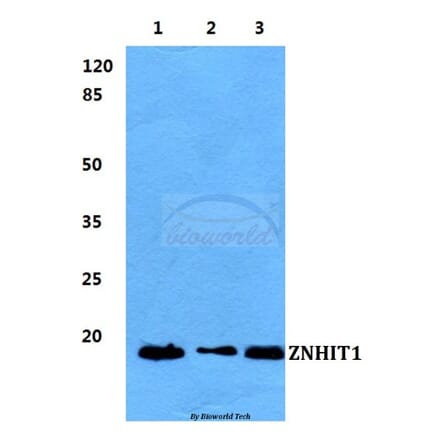 Anti-ZNHIT1 Antibody from Bioworld Technology (BS5982) - Antibodies.com