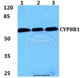 Anti-CYP8B1 Antibody from Bioworld Technology (BS5986) - Antibodies.com