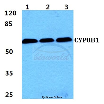 Anti-CYP8B1 Antibody from Bioworld Technology (BS5986) - Antibodies.com