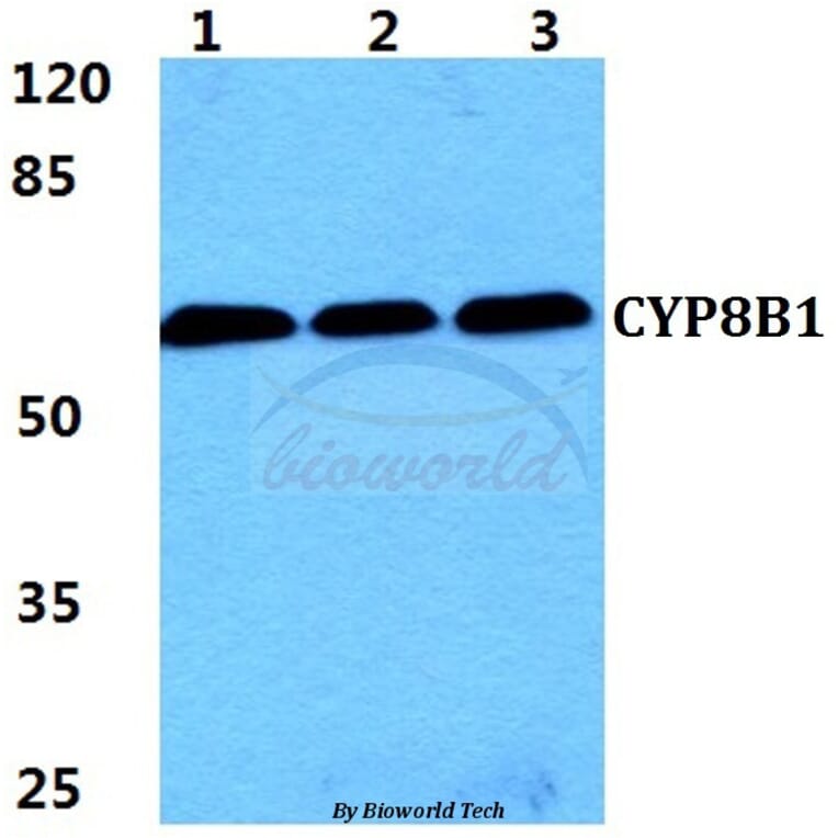 Anti-CYP8B1 Antibody from Bioworld Technology (BS5986) - Antibodies.com