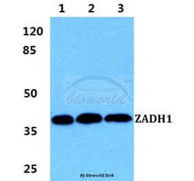 Anti-ZADH1 Antibody from Bioworld Technology (BS5987) - Antibodies.com