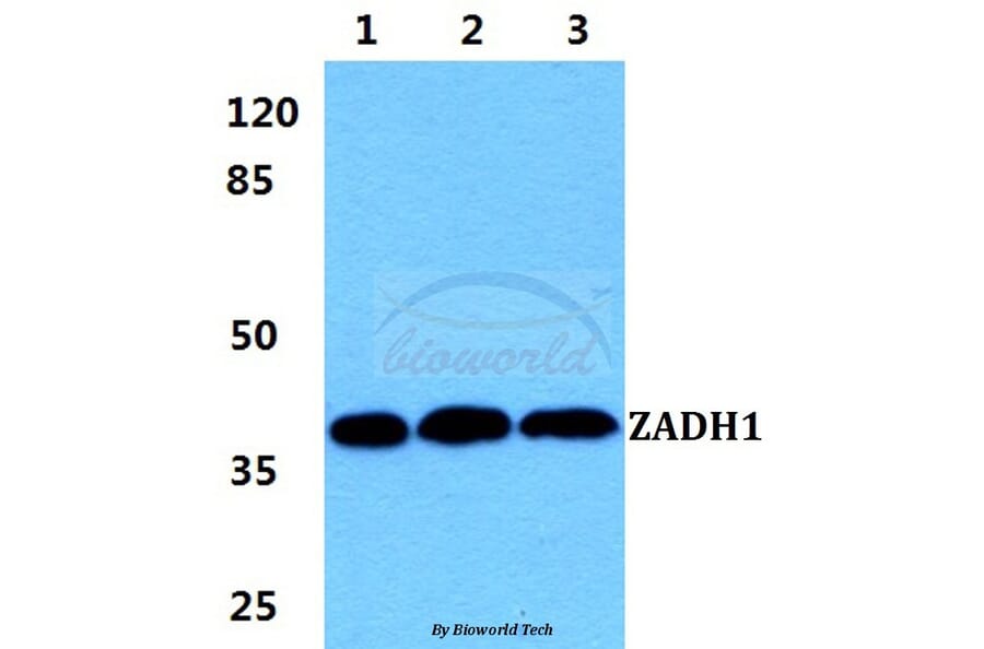 Anti-ZADH1 Antibody from Bioworld Technology (BS5987) - Antibodies.com