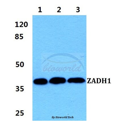 Anti-ZADH1 Antibody from Bioworld Technology (BS5987) - Antibodies.com