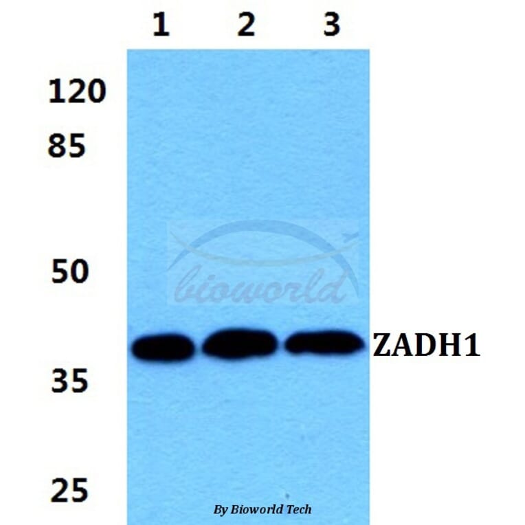 Anti-ZADH1 Antibody from Bioworld Technology (BS5987) - Antibodies.com