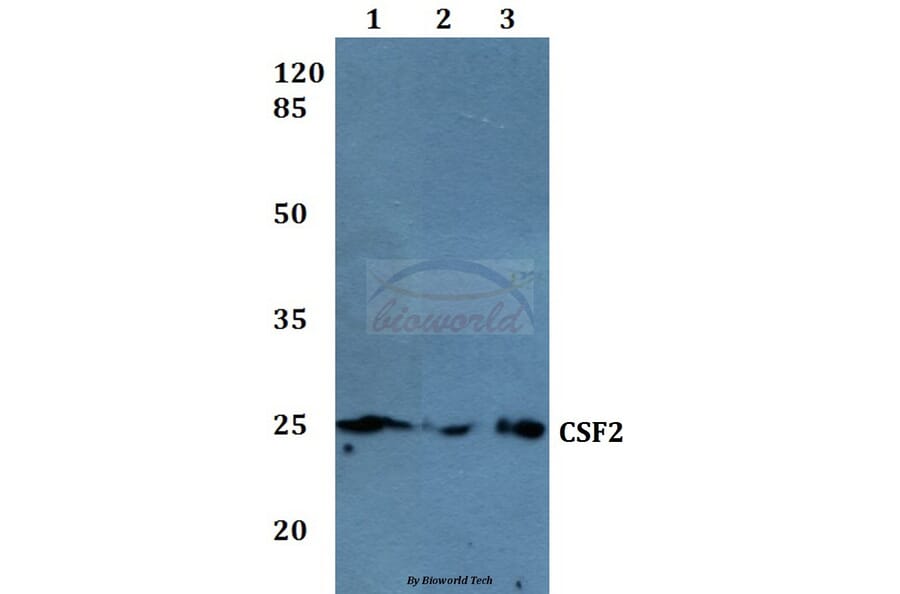 Anti-CSF2 Antibody from Bioworld Technology (BS60003) - Antibodies.com