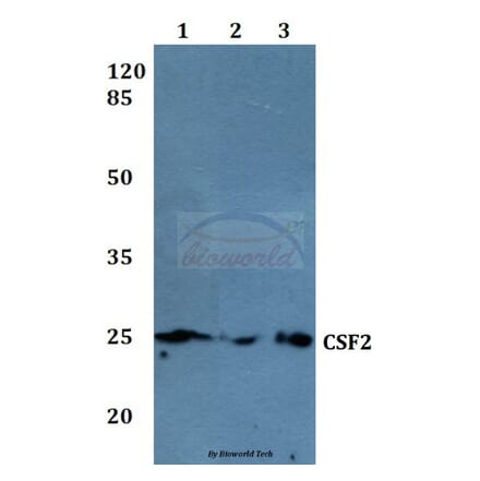 Anti-CSF2 Antibody from Bioworld Technology (BS60003) - Antibodies.com