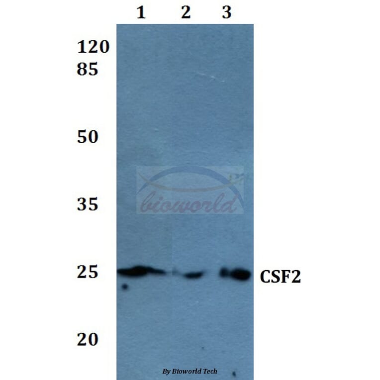 Anti-CSF2 Antibody from Bioworld Technology (BS60003) - Antibodies.com