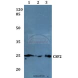 Anti-CSF2 Antibody from Bioworld Technology (BS60003) - Antibodies.com
