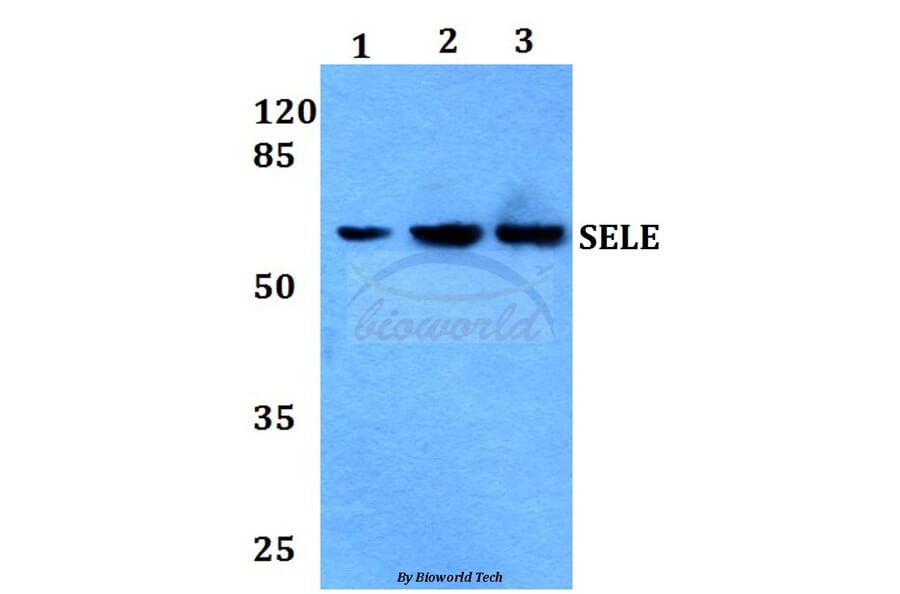 Anti-E-Selectin Antibody from Bioworld Technology (BS60008) - Antibodies.com