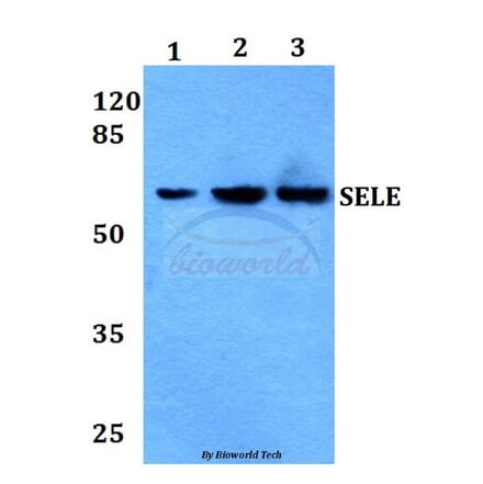 Anti-E-Selectin Antibody from Bioworld Technology (BS60008) - Antibodies.com