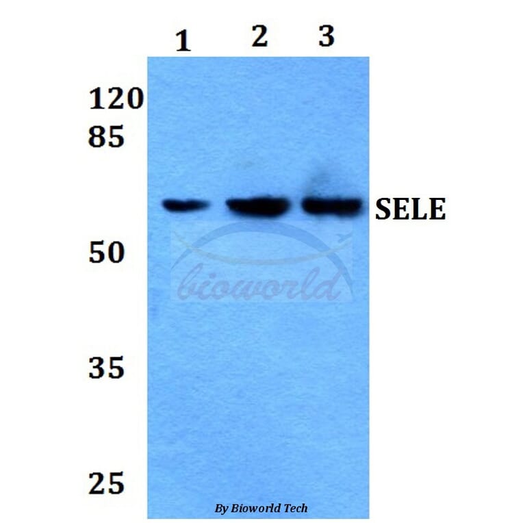 Anti-E-Selectin Antibody from Bioworld Technology (BS60008) - Antibodies.com