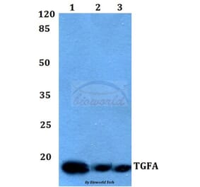Anti-TGFα Antibody from Bioworld Technology (BS60009) - Antibodies.com