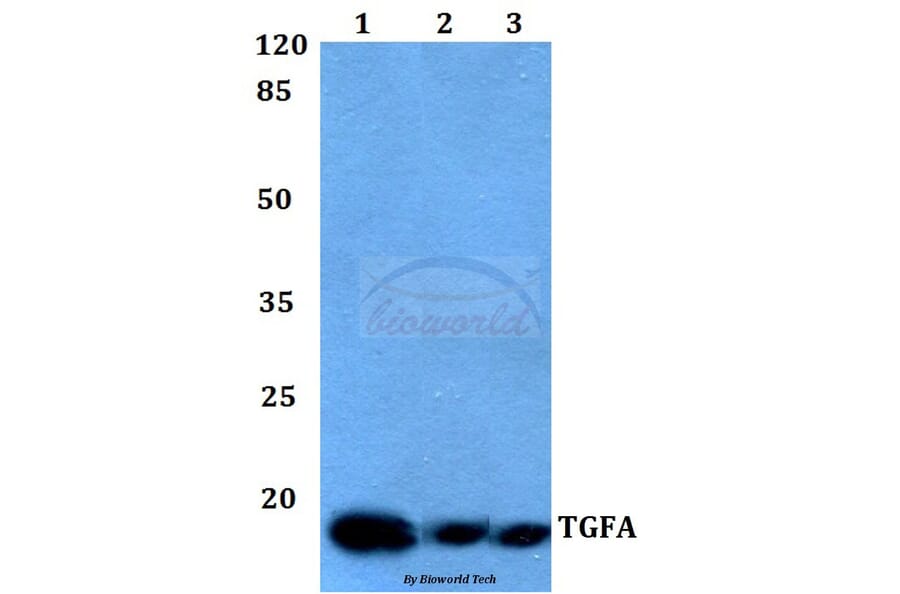 Anti-TGFα Antibody from Bioworld Technology (BS60009) - Antibodies.com