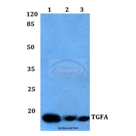 Anti-TGFα Antibody from Bioworld Technology (BS60009) - Antibodies.com