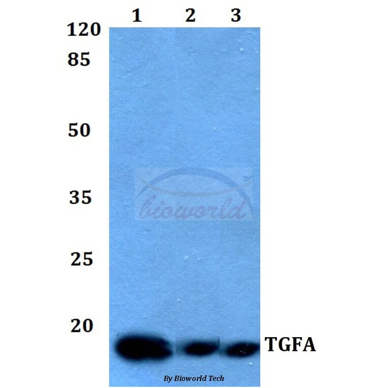 Anti-TGFα Antibody from Bioworld Technology (BS60009) - Antibodies.com