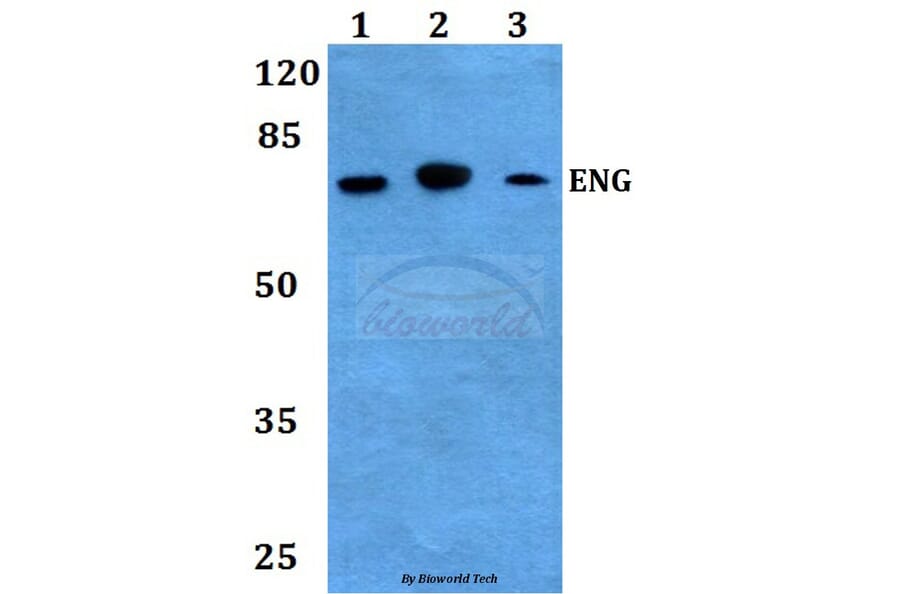 Anti-Endoglin Antibody from Bioworld Technology (BS60010) - Antibodies.com