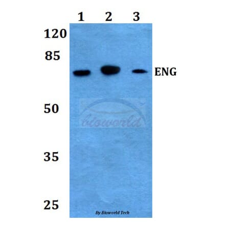 Anti-Endoglin Antibody from Bioworld Technology (BS60010) - Antibodies.com