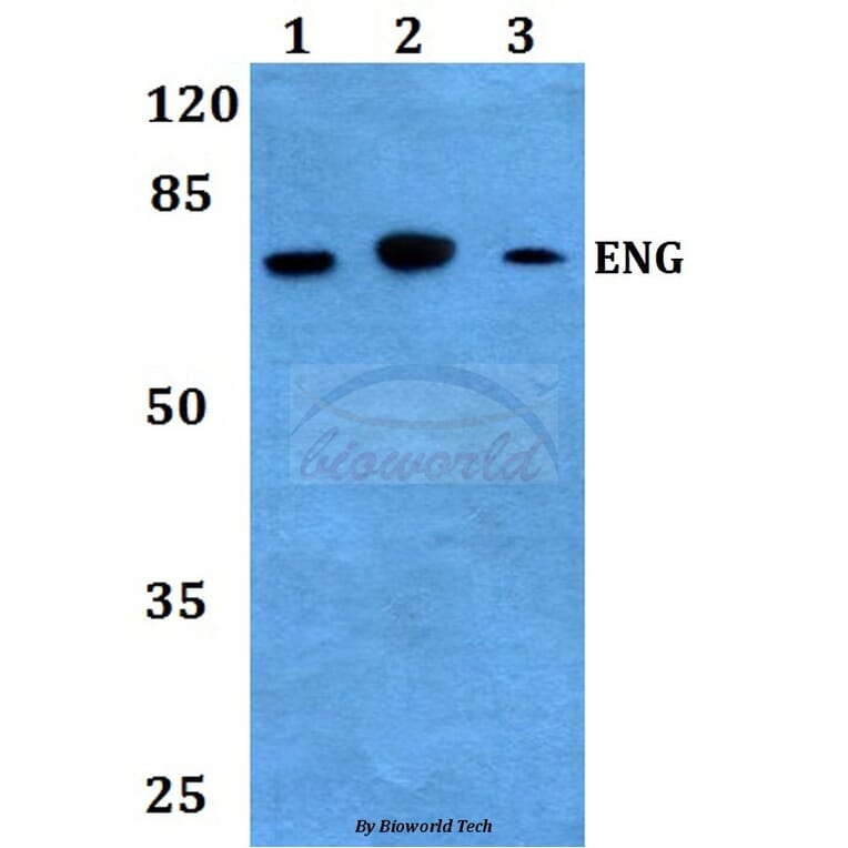 Anti-Endoglin Antibody from Bioworld Technology (BS60010) - Antibodies.com