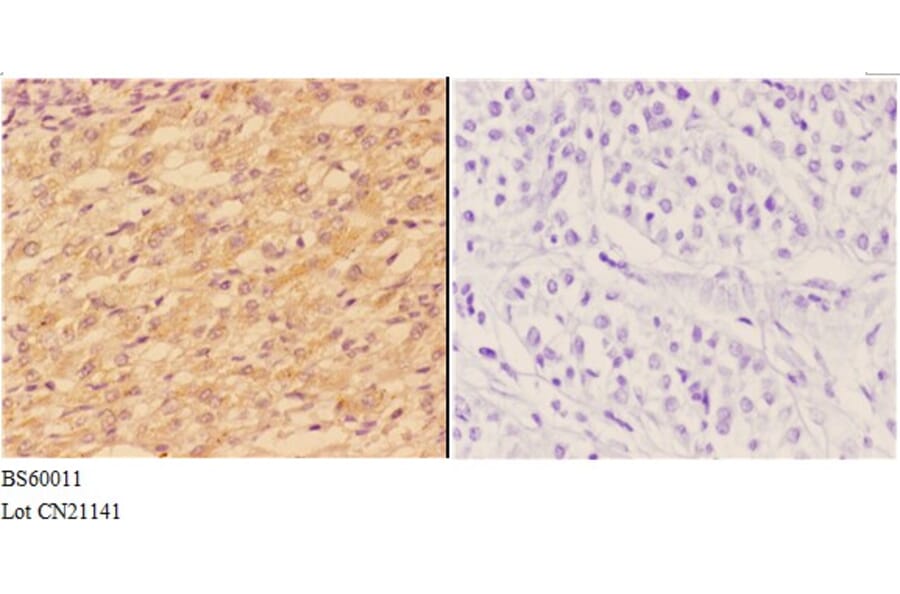 Anti-ABCA1 Antibody from Bioworld Technology (BS60011) - Antibodies.com