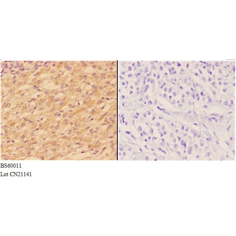 Anti-ABCA1 Antibody from Bioworld Technology (BS60011) - Antibodies.com