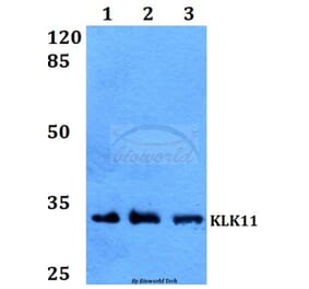 Anti-KLK11 Antibody from Bioworld Technology (BS60012) - Antibodies.com