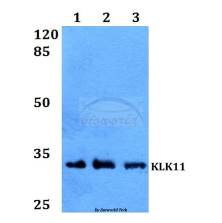 Anti-KLK11 Antibody from Bioworld Technology (BS60012) - Antibodies.com