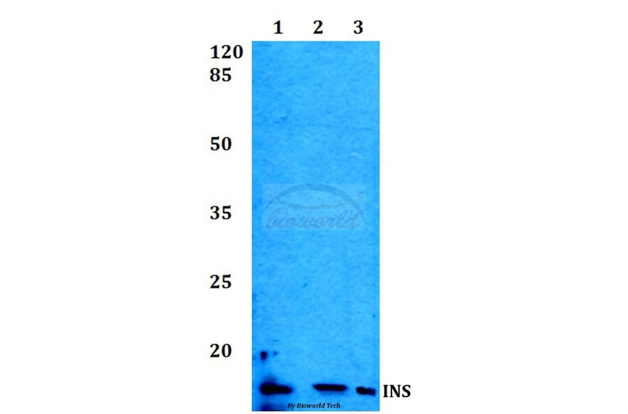 Anti-Insulin Antibody from Bioworld Technology (BS60014) - Antibodies.com
