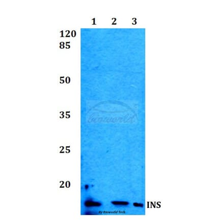 Anti-Insulin Antibody from Bioworld Technology (BS60014) - Antibodies.com