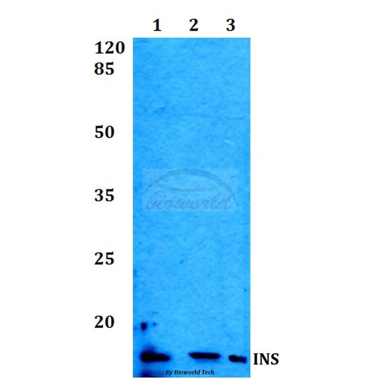 Anti-Insulin Antibody from Bioworld Technology (BS60014) - Antibodies.com