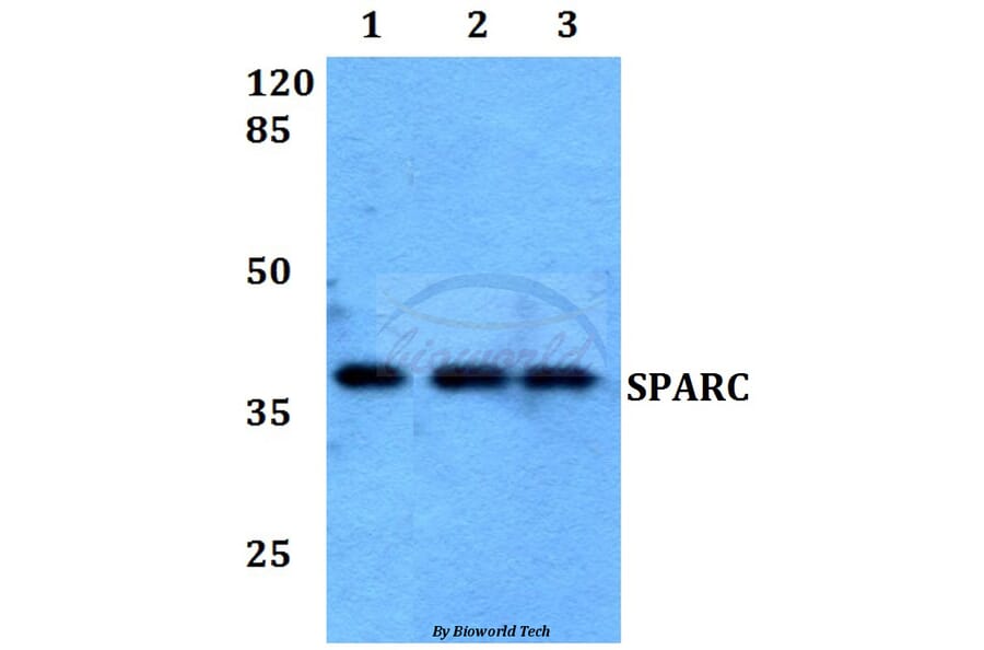 Anti-SPARC Antibody from Bioworld Technology (BS60017) - Antibodies.com