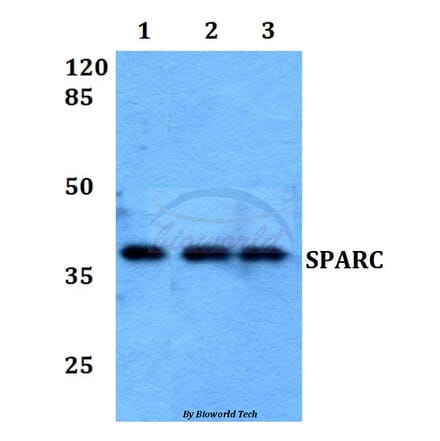 Anti-SPARC Antibody from Bioworld Technology (BS60017) - Antibodies.com