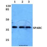 Anti-SPARC Antibody from Bioworld Technology (BS60017) - Antibodies.com