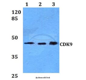 Anti-CDK9 Antibody from Bioworld Technology (BS60021) - Antibodies.com