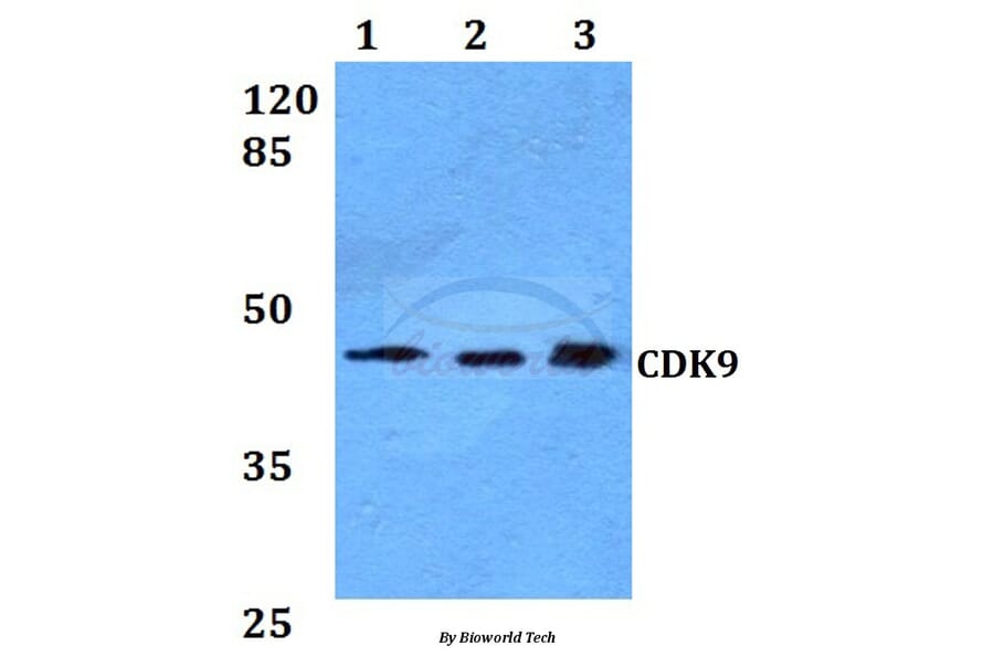 Anti-CDK9 Antibody from Bioworld Technology (BS60021) - Antibodies.com