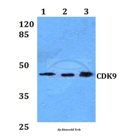 Anti-CDK9 Antibody from Bioworld Technology (BS60021) - Antibodies.com