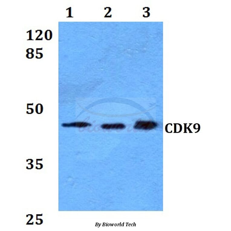 Anti-CDK9 Antibody from Bioworld Technology (BS60021) - Antibodies.com