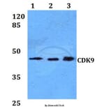 Anti-CDK9 Antibody from Bioworld Technology (BS60021) - Antibodies.com
