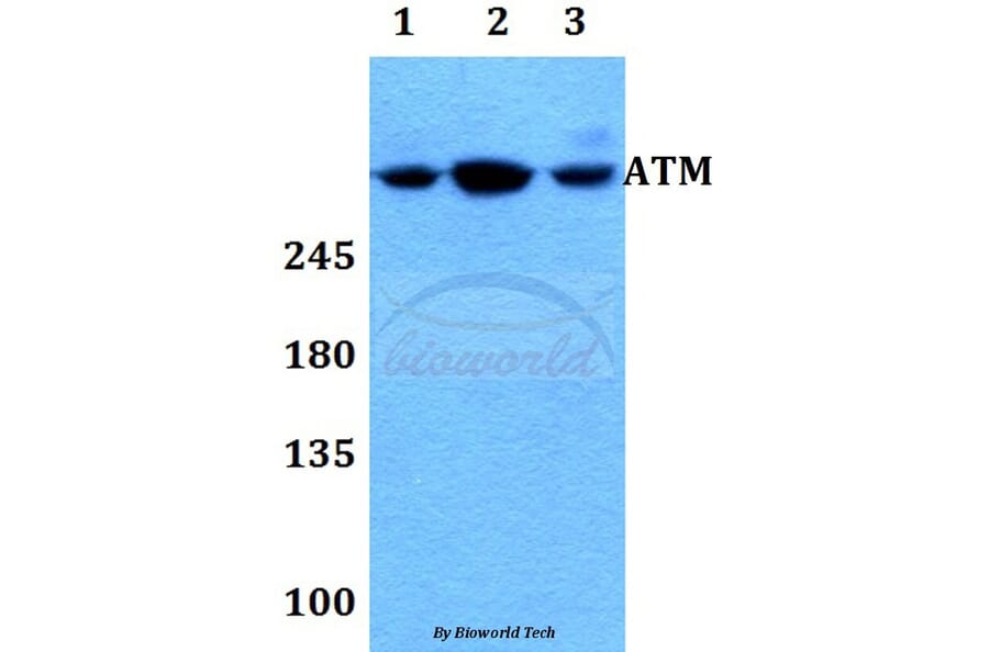Anti-ATM Antibody from Bioworld Technology (BS60023) - Antibodies.com