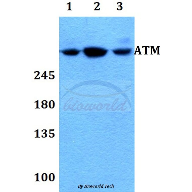 Anti-ATM Antibody from Bioworld Technology (BS60023) - Antibodies.com