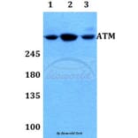 Anti-ATM Antibody from Bioworld Technology (BS60023) - Antibodies.com