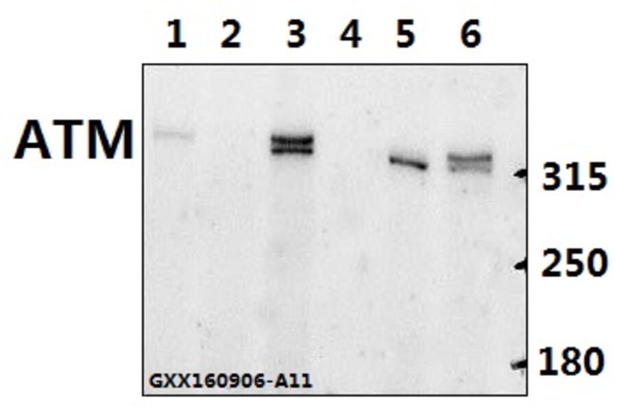 Anti-ATM Antibody from Bioworld Technology (BS60023) - Antibodies.com