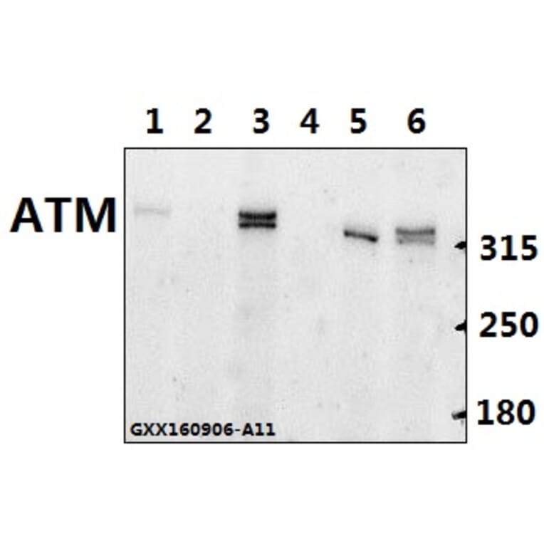 Anti-ATM Antibody from Bioworld Technology (BS60023) - Antibodies.com