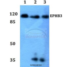 Anti-EphB3 Antibody from Bioworld Technology (BS60027) - Antibodies.com